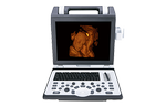 Аппарат УЗИ SIUI CTS-8800