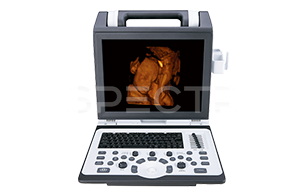 Аппарат УЗИ SIUI CTS-8800