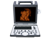 Аппарат УЗИ SIUI CTS-8800