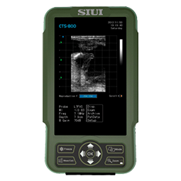 Аппарат УЗИ SIUI CTS-800